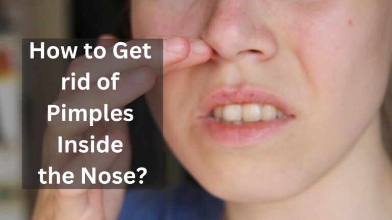How to Get rid of Pimples Inside the Nose?